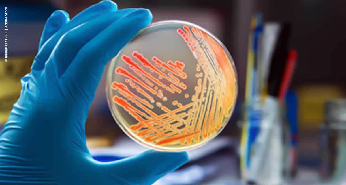 Salmonela e o controle integrado na cadeia produtiva de proteína animal